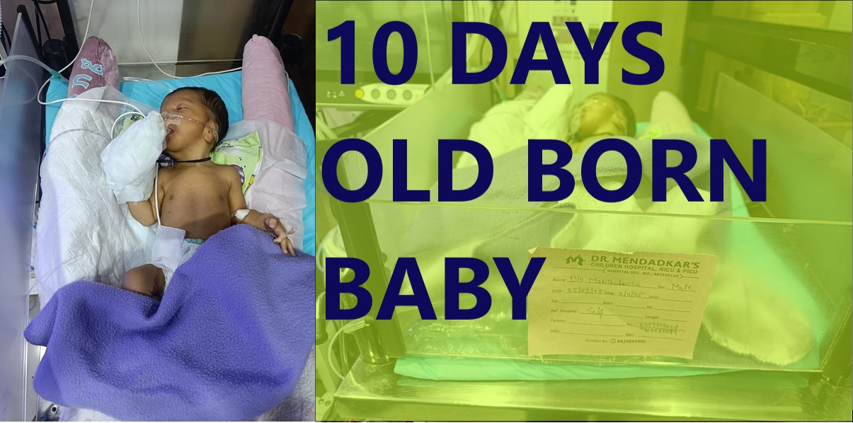 10 DAY OLD BORN BABY